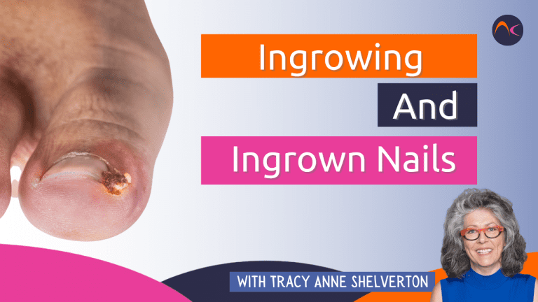 Ingrowning and ingrown nails